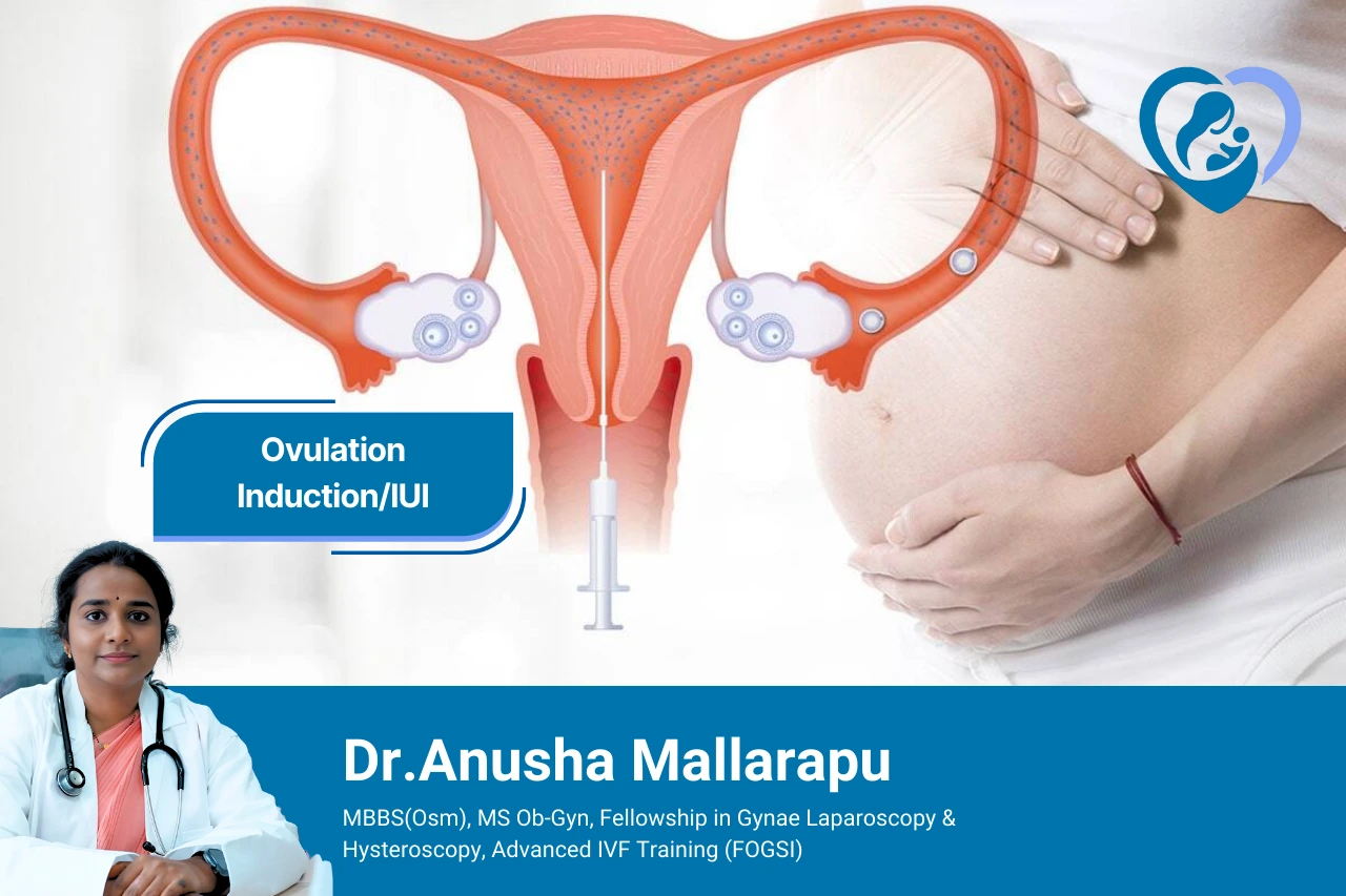 Ovulation Induction_IUI in hyderabad